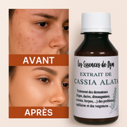 Huile Ultra Efficace Pour le Soins de la Peau