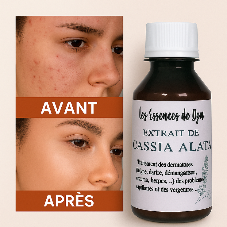 Huile Ultra Efficace Pour le Soins de la Peau