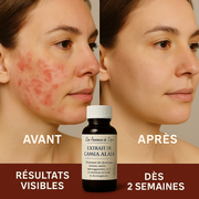 Huile Ultra Efficace Pour le Soins de la Peau